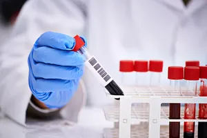За ошибки в медицинских анализах будут лишать лицензии в Кыргызстане